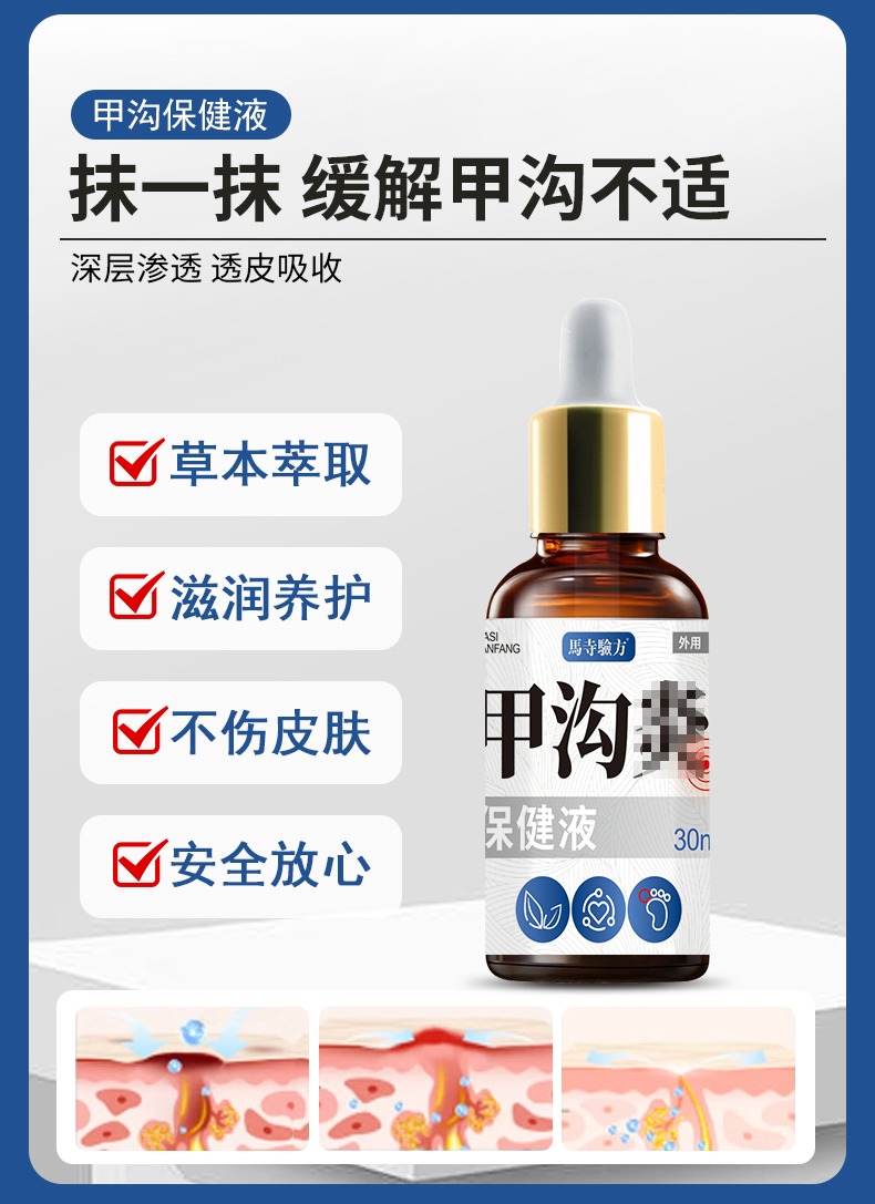 抹一抹，緩解甲溝不適